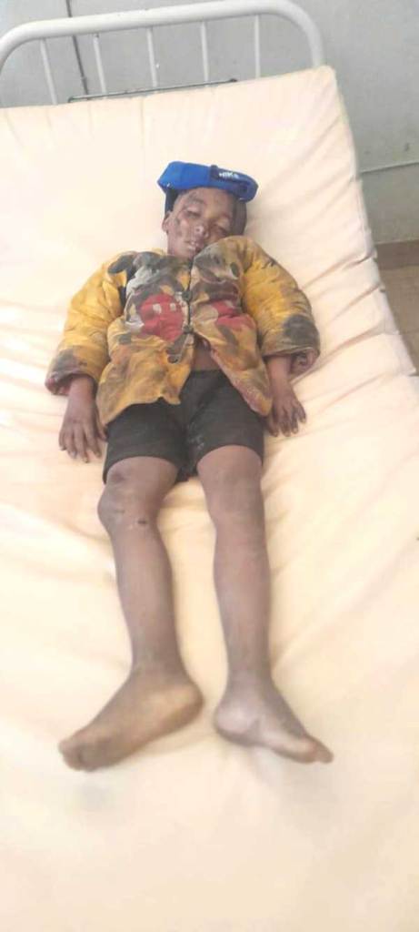 Image à la une de Ambodiafontsy Ampitatafika : Un garçon de 9 ans percuté par une voiture